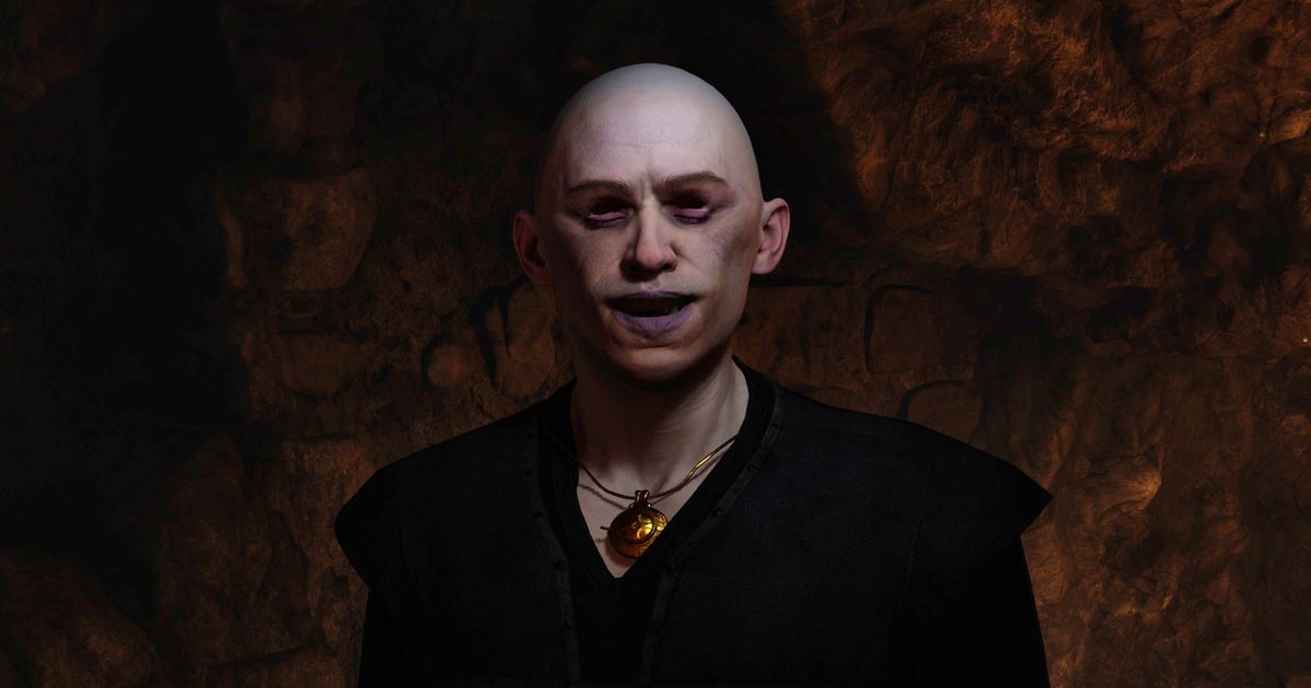 Read more about the article Oblivion Remastered has two updates coming, and one will save us from sudden glitchy vampire baldness