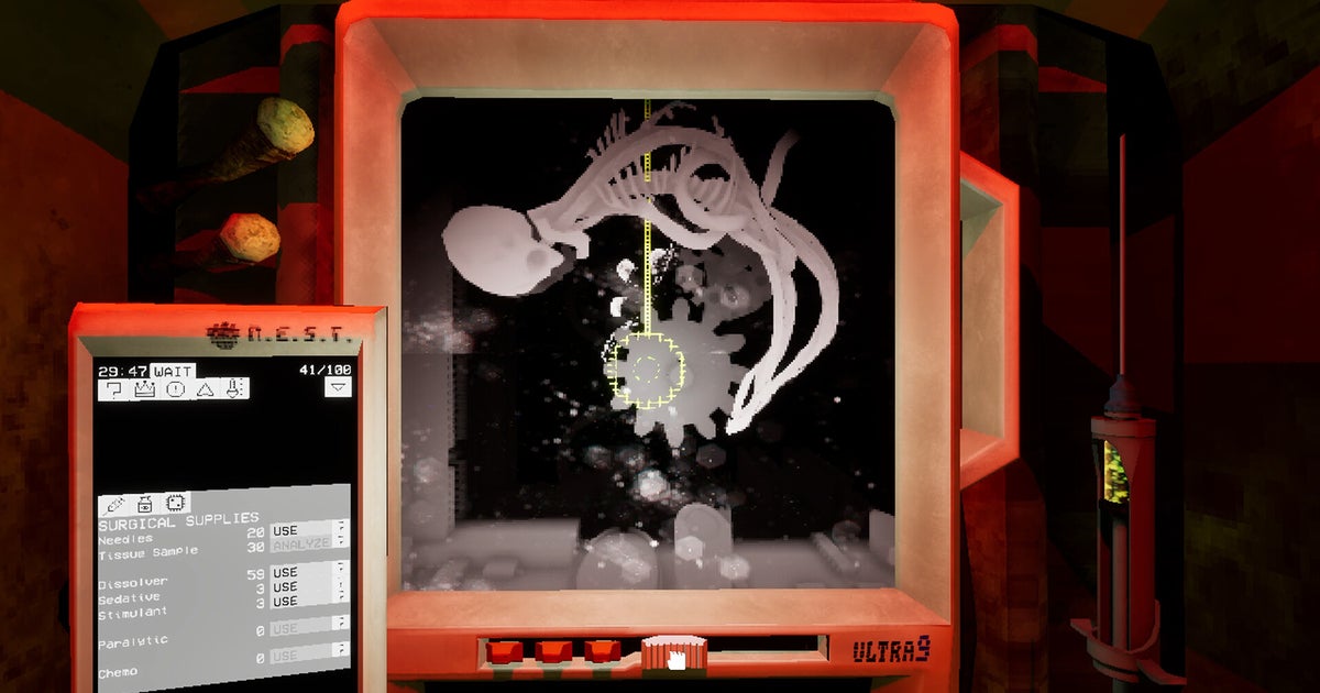 You are currently viewing Help a spaceship give birth before it collides with a star in Ultrasound